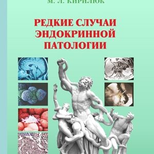 Редкие случаи эндокринной патологии
